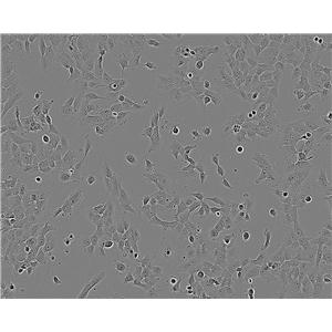 MDA-MB-231细胞：人乳腺癌细胞系