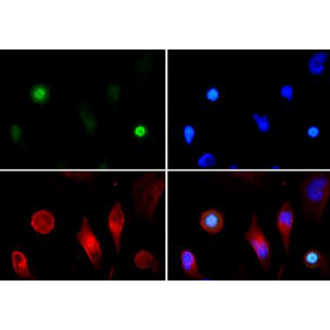 ANTI-HISTONE H3 (PHOSPHO T3,ACETYL K4)抗体