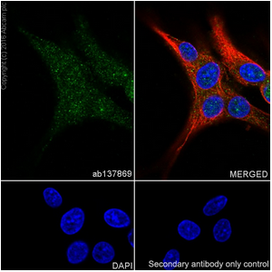 Anti-Tyrosine Hydroxylase