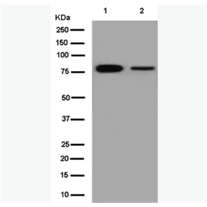 Anti-RANK antibody