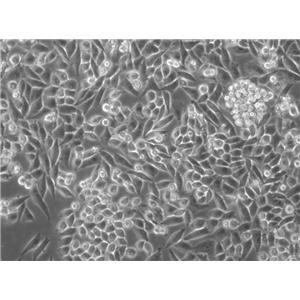 SNB-19:人胶质瘤复苏细胞(提供STR鉴定图谱)