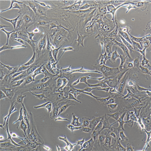 LNCaPcloneFGC人前列腺癌细胞