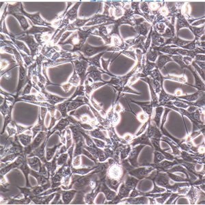 U251成纤维细胞人神经胶质瘤细胞