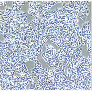 Tca-83人口腔鳞癌细胞