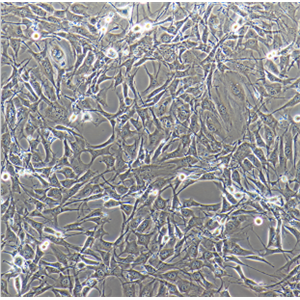 RL-95-2人子宫内膜癌细胞