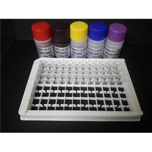 人抗核周因子抗体(APF)Elisa试剂盒