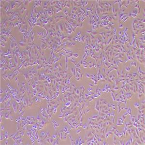 SK-MEL-2-LUC(人皮肤黑色素瘤细胞-荧光素酶标记（STR鉴定正确）)