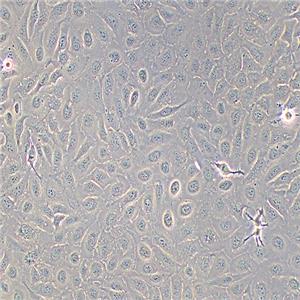 SK-OV-3-LUC（人卵巢癌细胞-荧光素酶标记（STR鉴定正确））