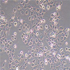 T24-LUC（人膀胱癌细胞-荧光素酶标记（STR鉴定正确））