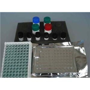 琼脂糖凝胶回收试剂盒（磁珠法）生产供应商艾普蒂生物
