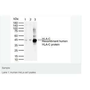 Anti-HLA-C antibody-组织相容性蛋白1单克隆抗体