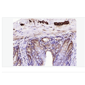 Anti-Calretinin antibody- 钙结合蛋白重组兔单克隆抗体