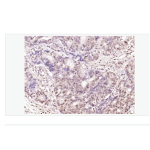 Anti-BTG3 antibody-高表达神经上皮蛋白BTG3抗体