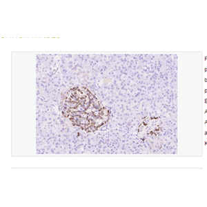 Anti-Glucagon antibody -胰高血糖素抗体