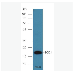 Anti-SOD1 antibody-超氧化物歧化酶1（铜/锌过氧化物歧化酶SOD抗体)