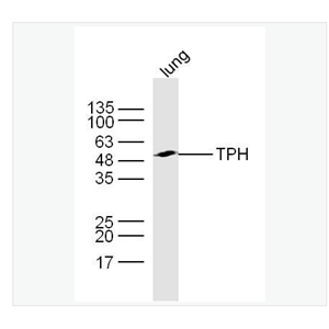 Anti-TPH antibody  -色氨酸羟化酶抗体