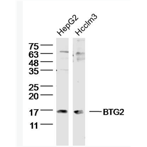 BTG2 B细胞迁移基因2抗体