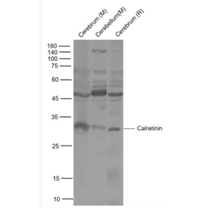 Calretinin 钙结合蛋白抗体