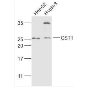 Anti-GST1 antibody-谷胱甘肽转移酶抗体