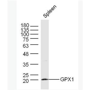 Anti-GPX1 antibody-谷胱甘肽过氧化酶1