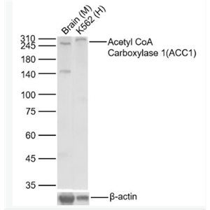 Anti-ACACAantibody-乙酰辅酶A羧化酶重组兔单抗