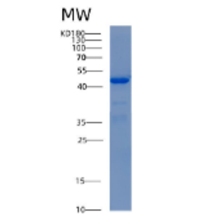 Recombinant Human ADH5 Protein