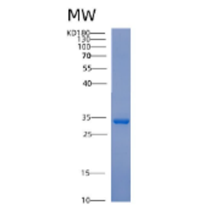 Recombinant Human ACTN1 Protein