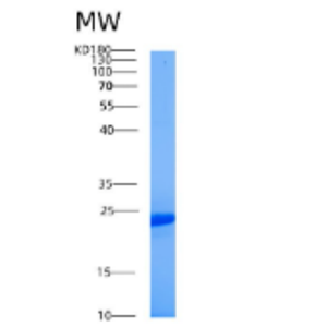 Recombinant Human AES Protein