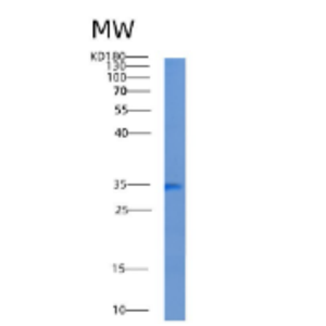 Recombinant Human ADAL Protein