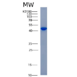 Recombinant Human ADH6 Protein