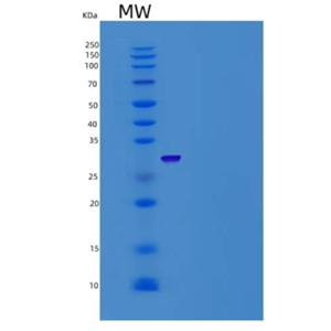 Recombinant Human RPE Protein (His Tag)