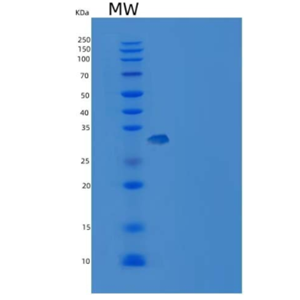 Recombinant Human Carbonic Anhydrase IV / CA4 Protein (His tag)