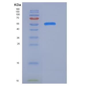 Recombinant Mouse CD166 / ALCAM Protein (His Tag)