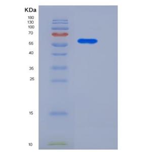 Recombinant Human CD146 / MCAM Protein (His tag)