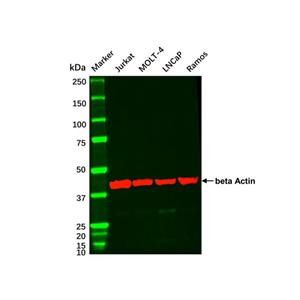 aladdin 阿拉丁 cl155902 LNCaP Whole Cell Lysate Mycoplasma free