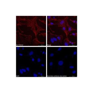 aladdin 阿拉丁 Ab170151 Goat Anti-Rabbit IgG H&L (TRITC) Secondary Antibody; Goat Anti-Rabbit IgG H&L (TRITC); IF, Flow