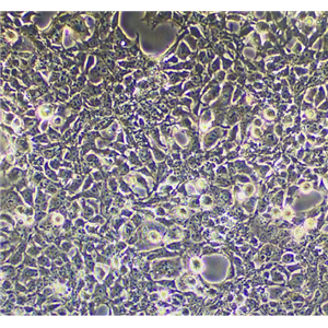 小鼠胰腺癌细胞/胰腺导管癌PAN02