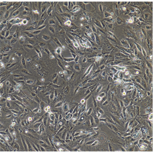 人肺癌细胞(淋巴结转移)NCI-H292/LUC-E/GFP