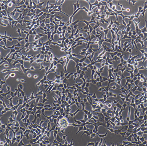 人恶性黑色素瘤细胞A375/LUC-E/GFP